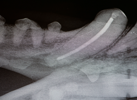 x-ray_of_root_canal_therapy