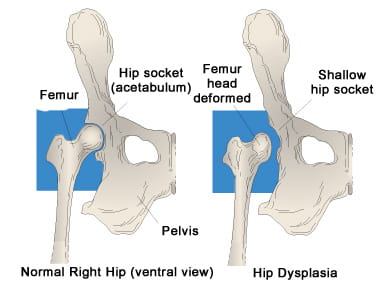 dog-hip_dysplasia