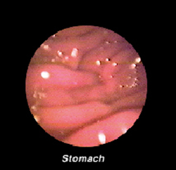 endoscopy-gastrointestinal-2_2009