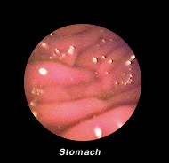 gastrointestinal_endoscopy-2