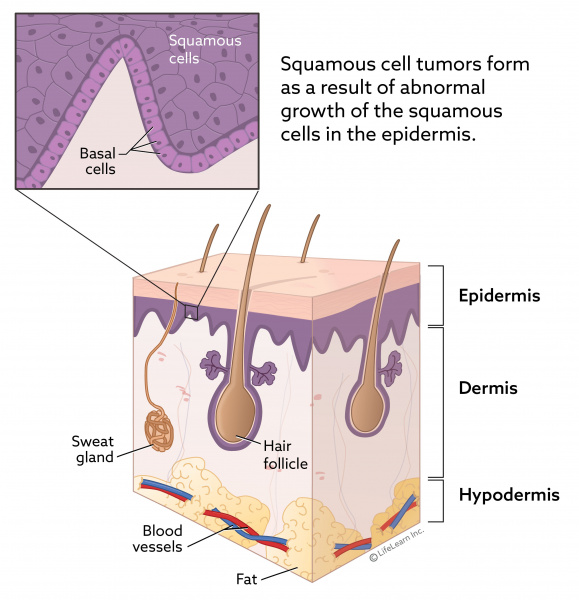 skin_layers_squamous_cell_2018