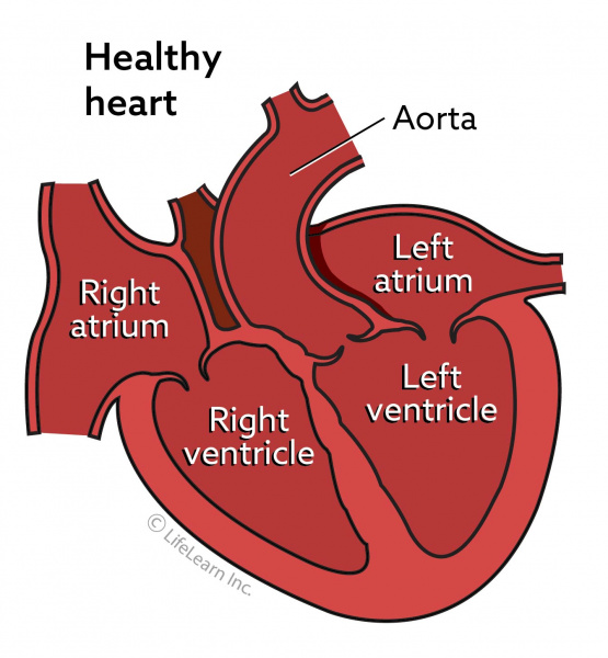 signs of dilated cardiomyopathy in dogs